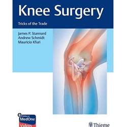 Knee Surgery: Tricks of the Trade